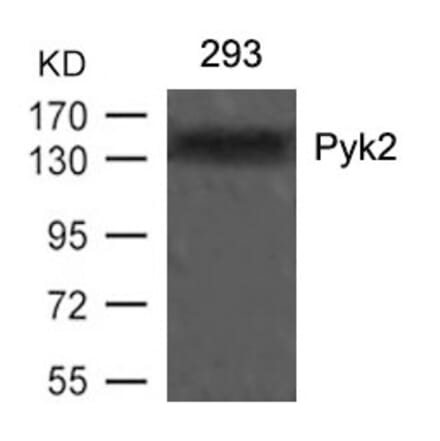Western blot - Pyk2 (Ab-402) Antibody from Signalway Antibody (21209) - Antibodies.com