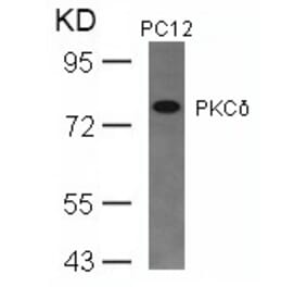 Western blot - PKCd (Ab-645) Antibody from Signalway Antibody (21288) - Antibodies.com