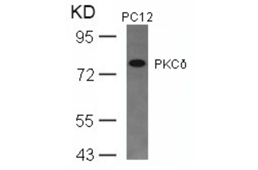 Western blot - PKCd (Ab-645) Antibody from Signalway Antibody (21288) - Antibodies.com
