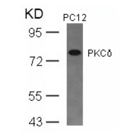 Western blot - PKCd (Ab-645) Antibody from Signalway Antibody (21288) - Antibodies.com