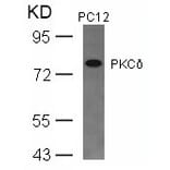 Western blot - PKCd (Ab-645) Antibody from Signalway Antibody (21288) - Antibodies.com