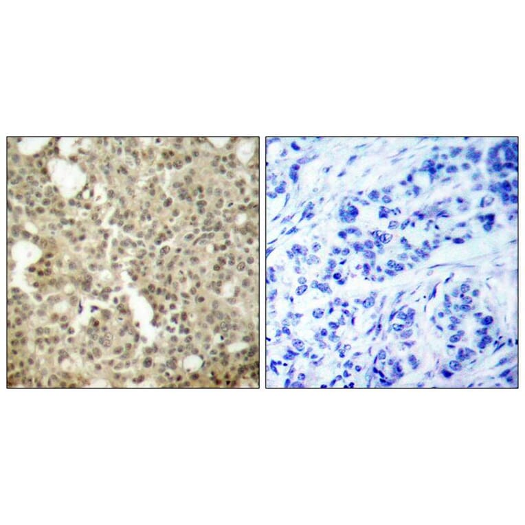 Immunohistochemistry - PKCd (Ab-645) Antibody from Signalway Antibody (21288) - Antibodies.com