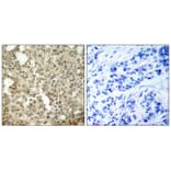 Immunohistochemistry - PKCd (Ab-645) Antibody from Signalway Antibody (21288) - Antibodies.com