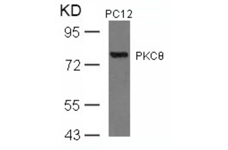Western blot - PKCth (Ab-676) Antibody from Signalway Antibody (21289) - Antibodies.com