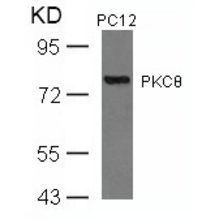 Western blot - PKCth (Ab-676) Antibody from Signalway Antibody (21289) - Antibodies.com