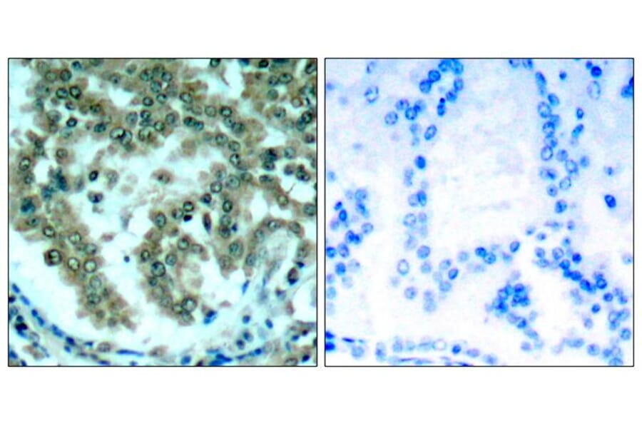 Immunohistochemistry - PKCth (Ab-676) Antibody from Signalway Antibody (21289) - Antibodies.com
