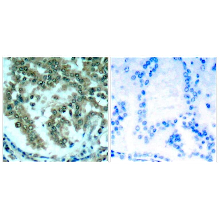 Immunohistochemistry - PKCth (Ab-676) Antibody from Signalway Antibody (21289) - Antibodies.com