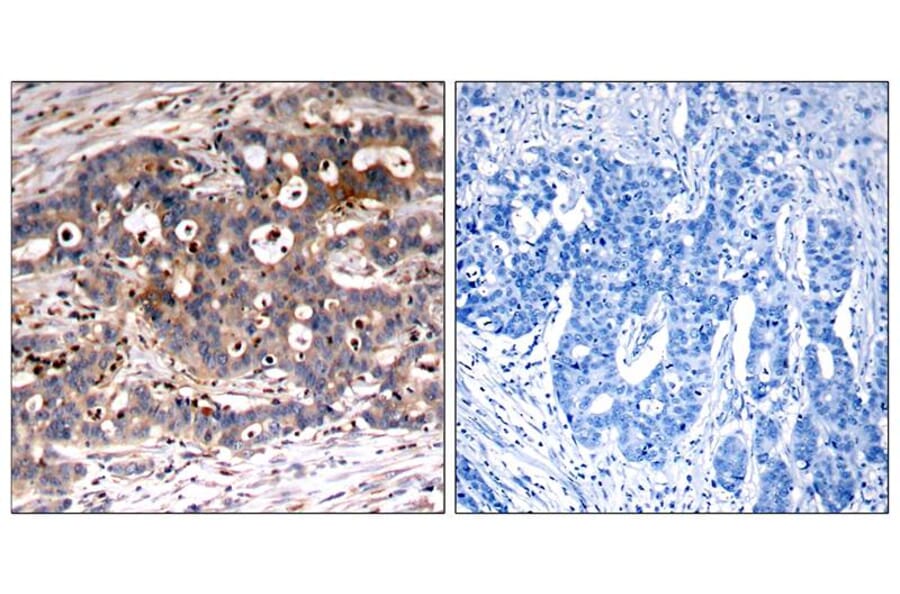 Immunohistochemistry - Shc1 (Ab-427) Antibody from Signalway Antibody (21317) - Antibodies.com