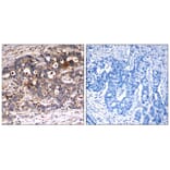 Immunohistochemistry - Shc1 (Ab-427) Antibody from Signalway Antibody (21317) - Antibodies.com