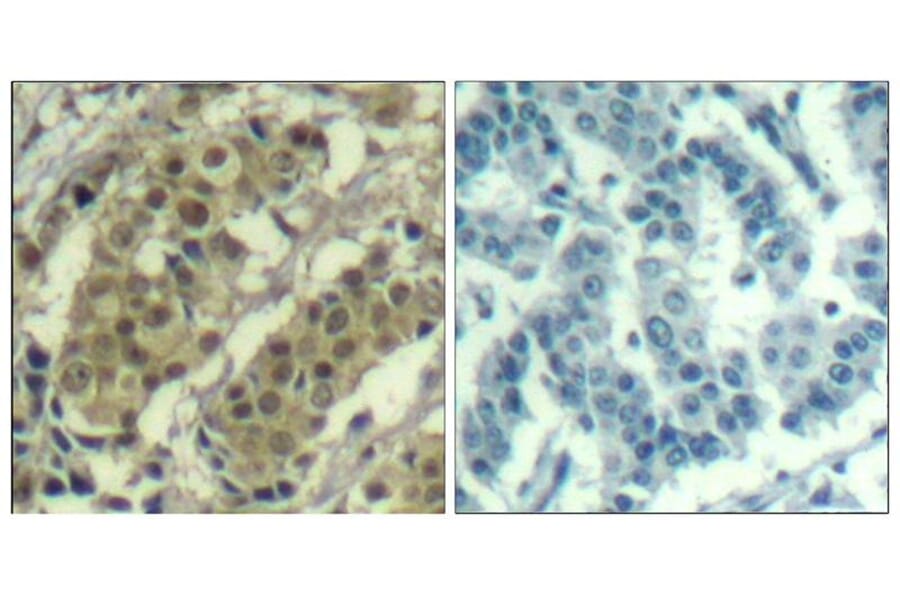 Immunohistochemistry - AKT1 (Ab-450) Antibody from Signalway Antibody (21502) - Antibodies.com