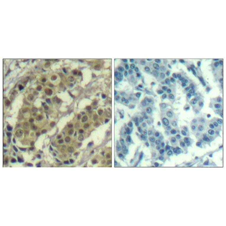 Immunohistochemistry - AKT1 (Ab-450) Antibody from Signalway Antibody (21502) - Antibodies.com