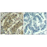 Immunohistochemistry - AKT1 (Ab-450) Antibody from Signalway Antibody (21502) - Antibodies.com