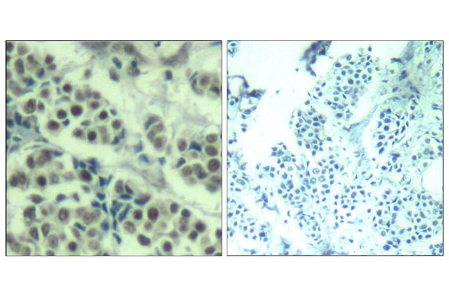 Immunohistochemistry - MDM2 (Ab-166) Antibody from Signalway Antibody (21550) - Antibodies.com
