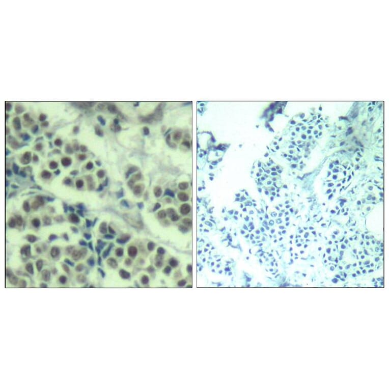 Immunohistochemistry - MDM2 (Ab-166) Antibody from Signalway Antibody (21550) - Antibodies.com