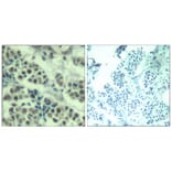 Immunohistochemistry - MDM2 (Ab-166) Antibody from Signalway Antibody (21550) - Antibodies.com