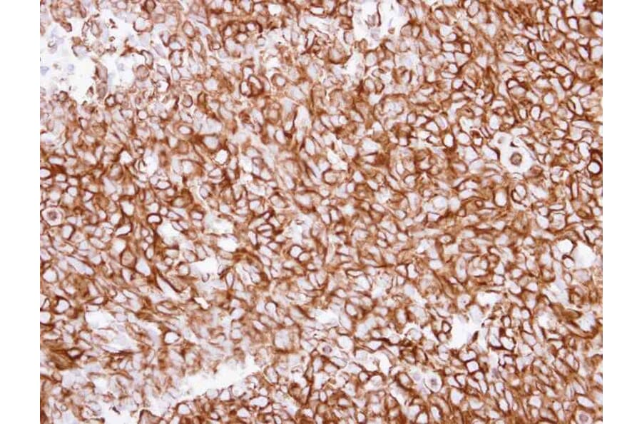 Immunohistochemistry - alpha Tubulin antibody from Signalway Antibody (22038) - Antibodies.com