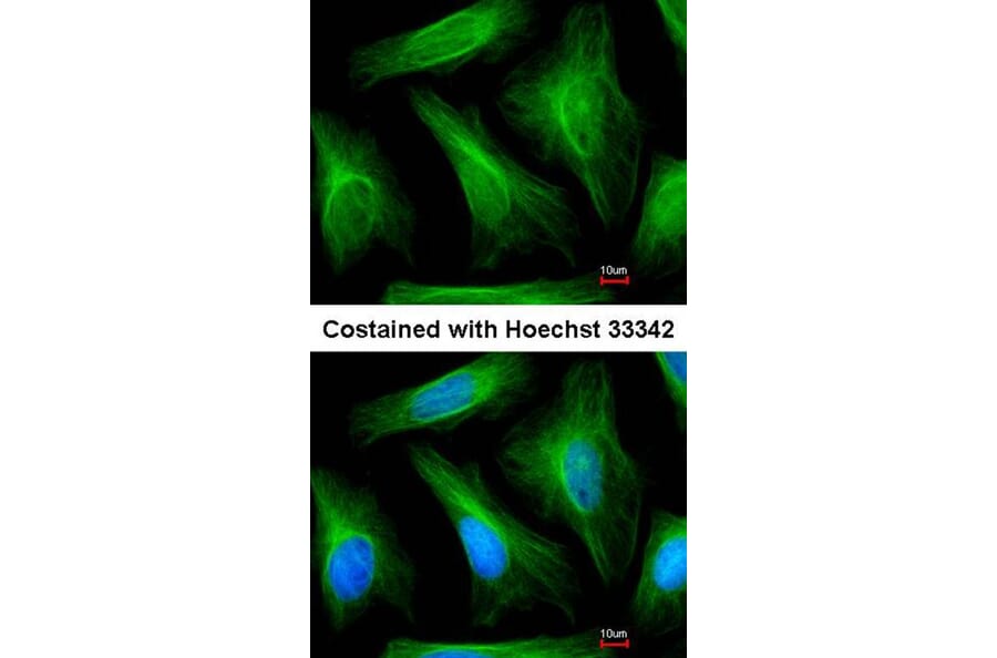 Immunofluorescence - alpha Tubulin antibody from Signalway Antibody (22038) - Antibodies.com