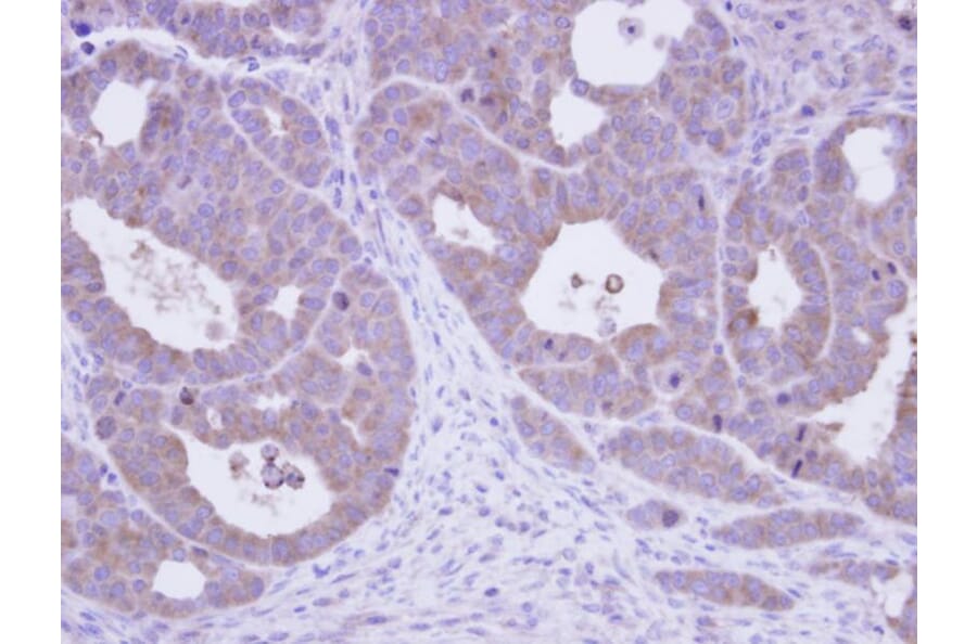 Immunohistochemistry - TCP-1 epsilon antibody from Signalway Antibody (22414) - Antibodies.com