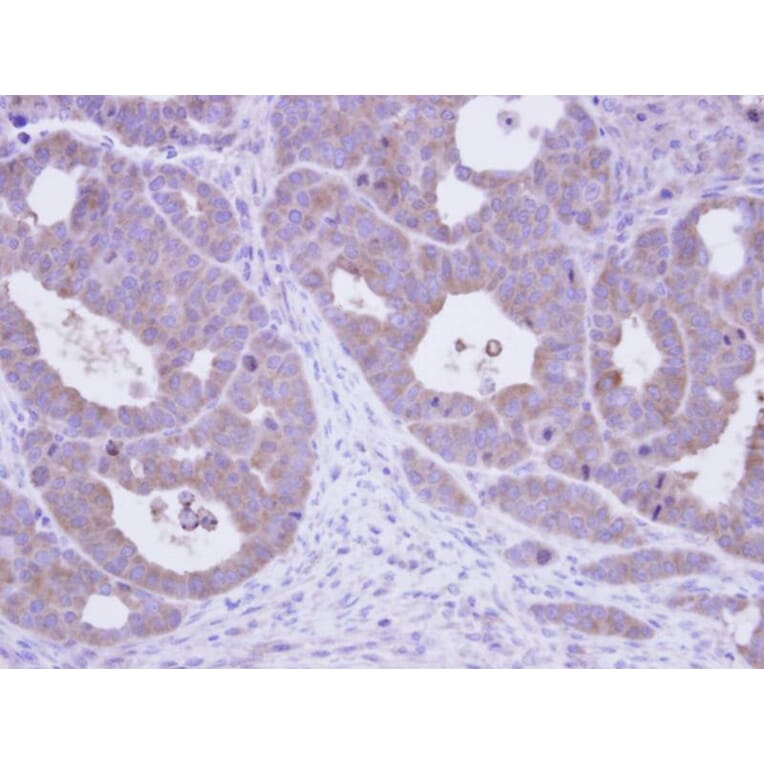 Immunohistochemistry - TCP-1 epsilon antibody from Signalway Antibody (22414) - Antibodies.com