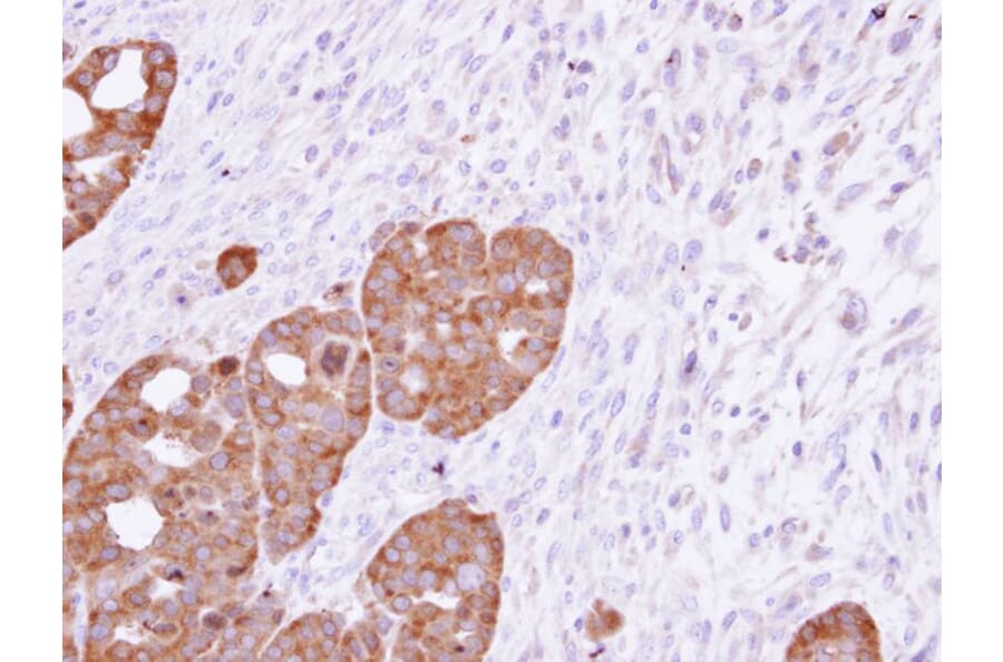 Immunohistochemistry - TCP-1 epsilon antibody from Signalway Antibody (22415) - Antibodies.com