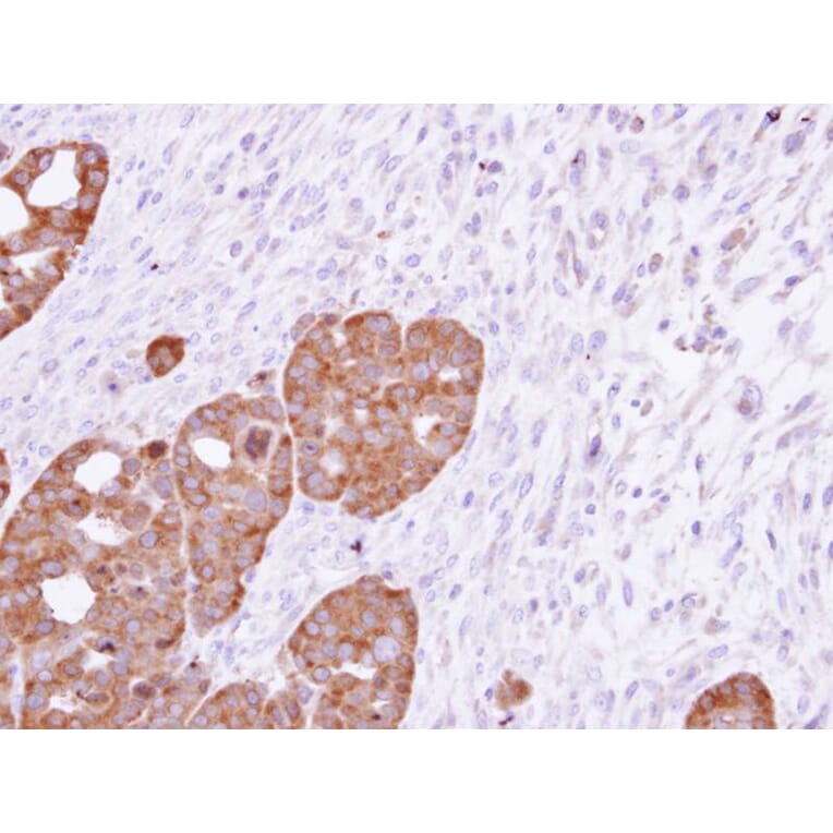 Immunohistochemistry - TCP-1 epsilon antibody from Signalway Antibody (22415) - Antibodies.com