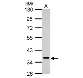 Sec61 alpha-1 antibody from Signalway Antibody (22801) - Antibodies.com