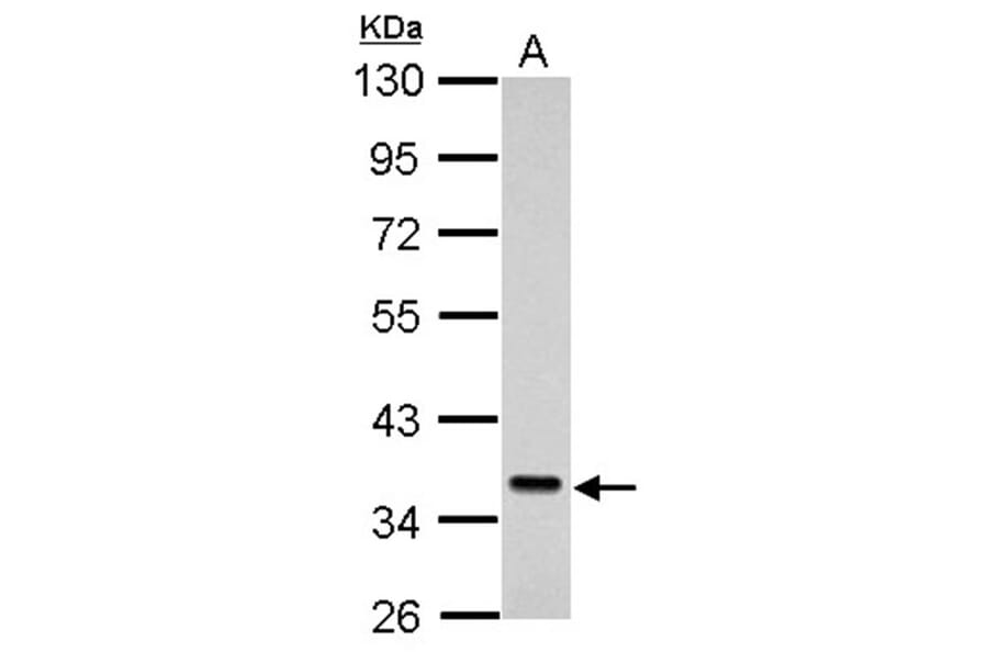 Sec61 alpha-1 antibody from Signalway Antibody (22801) - Antibodies.com