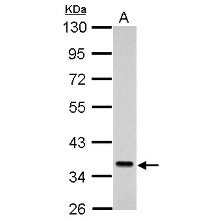 Sec61 alpha-1 antibody from Signalway Antibody (22801) - Antibodies.com