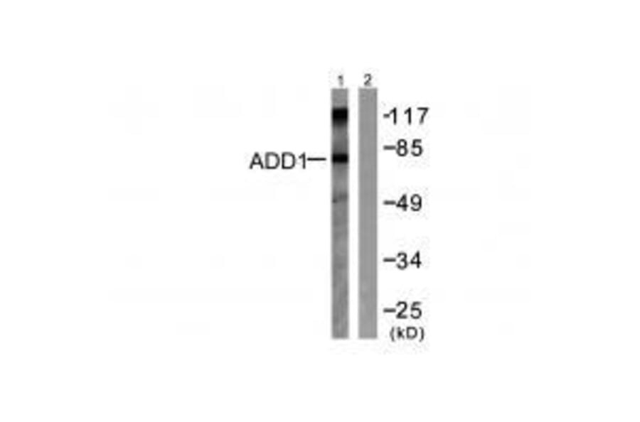 Western blot - ADD1 (Ab-726) Antibody from Signalway Antibody (33115) - Antibodies.com