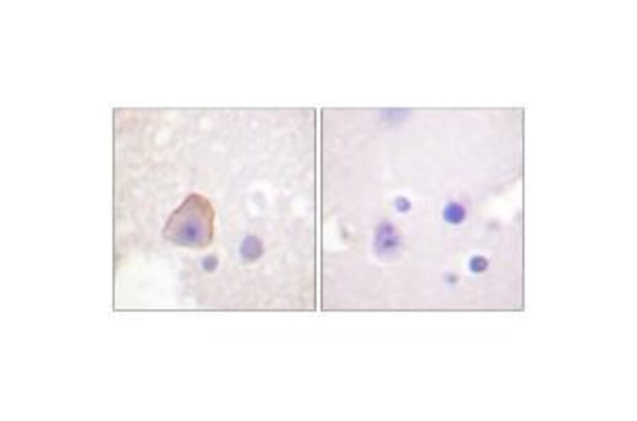 Immunohistochemistry - ADD1 (Ab-726) Antibody from Signalway Antibody (33115) - Antibodies.com
