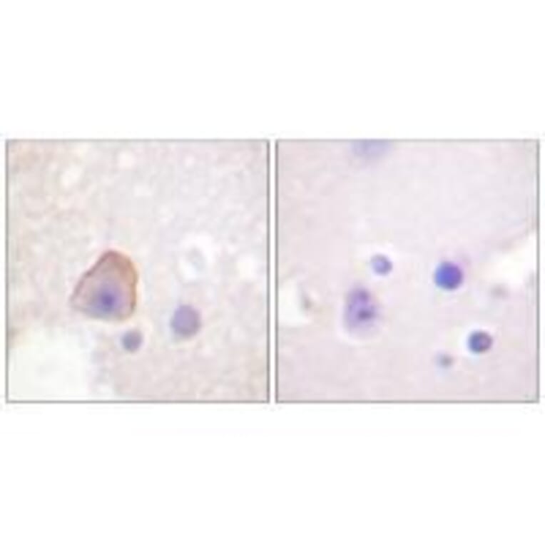 Immunohistochemistry - ADD1 (Ab-726) Antibody from Signalway Antibody (33115) - Antibodies.com