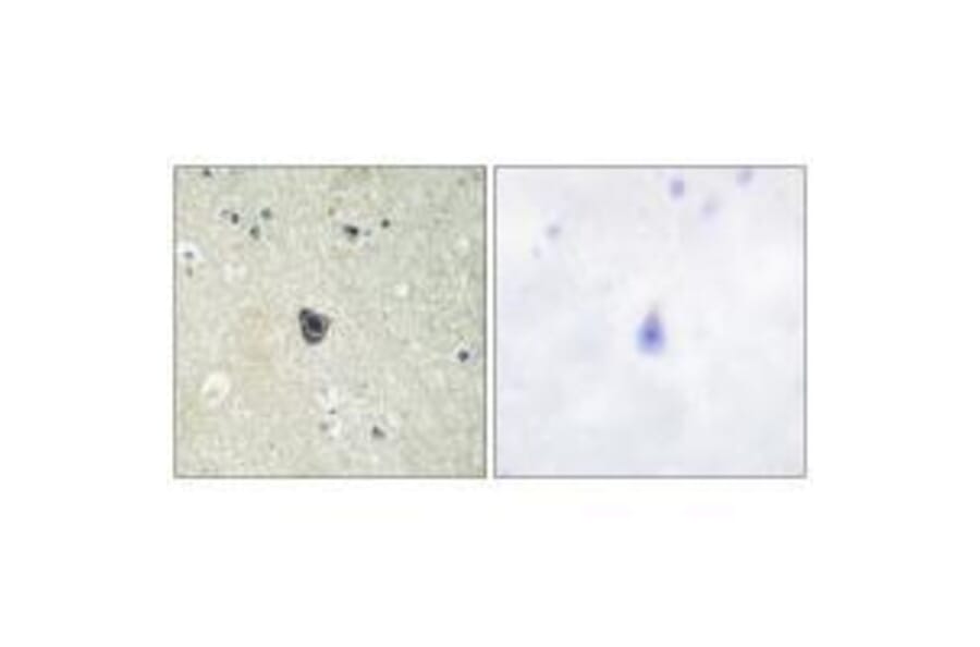 Immunohistochemistry - CSFR (Ab-809) Antibody from Signalway Antibody (33156) - Antibodies.com