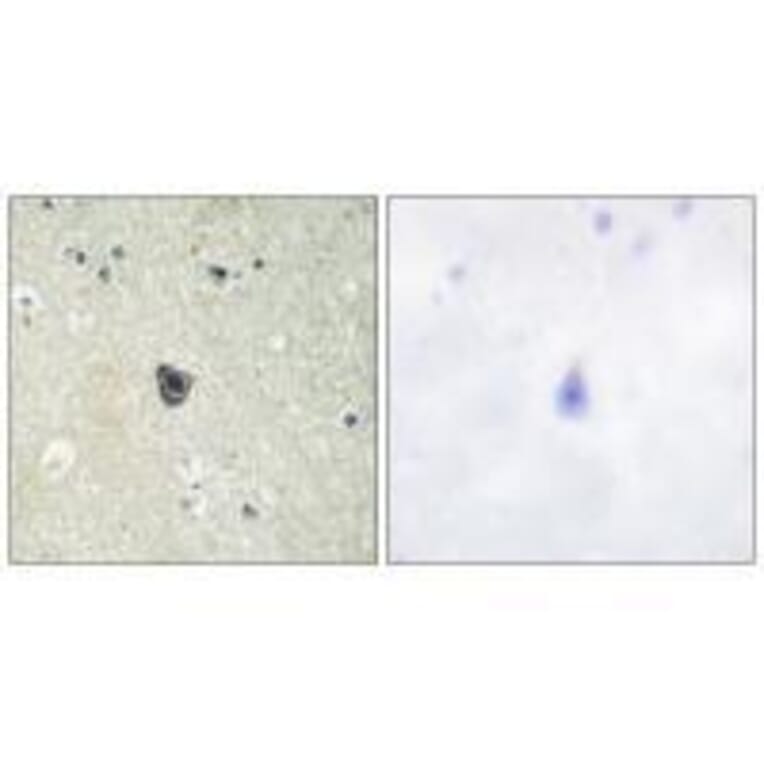 Immunohistochemistry - CSFR (Ab-809) Antibody from Signalway Antibody (33156) - Antibodies.com