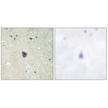 Immunohistochemistry - CSFR (Ab-809) Antibody from Signalway Antibody (33156) - Antibodies.com