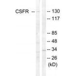 Western blot - CSFR (Ab-809) Antibody from Signalway Antibody (33156) - Antibodies.com