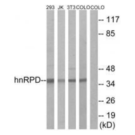 Western blot - hnRPD (Ab-83) Antibody from Signalway Antibody (33167) - Antibodies.com