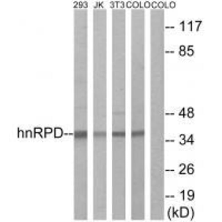 Western blot - hnRPD (Ab-83) Antibody from Signalway Antibody (33167) - Antibodies.com