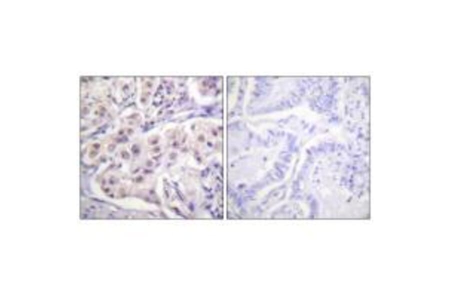 Immunohistochemistry - hnRPD (Ab-83) Antibody from Signalway Antibody (33167) - Antibodies.com