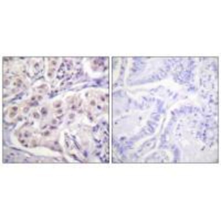 Immunohistochemistry - hnRPD (Ab-83) Antibody from Signalway Antibody (33167) - Antibodies.com