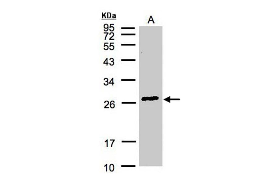 glutathione S-transferase alpha 2 antibody from Signalway Antibody (22142) - Antibodies.com