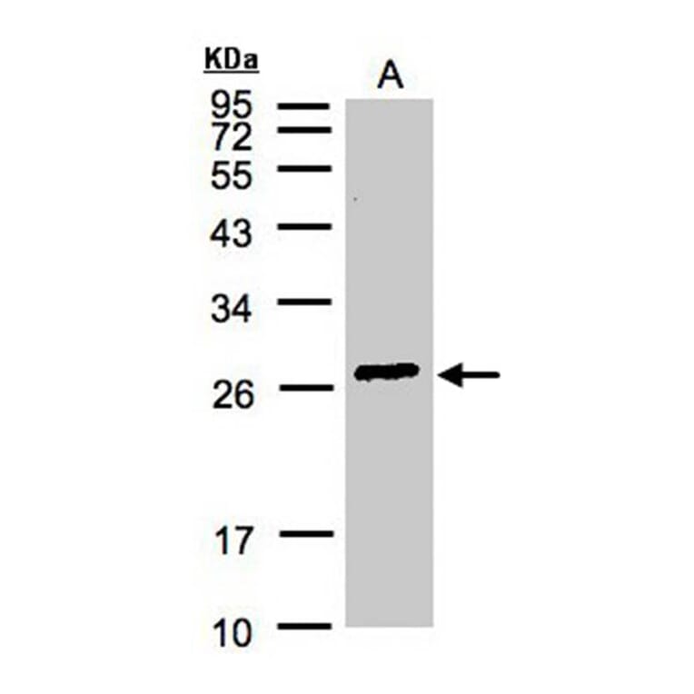 glutathione S-transferase alpha 2 antibody from Signalway Antibody (22142) - Antibodies.com