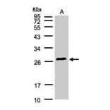 glutathione S-transferase alpha 2 antibody from Signalway Antibody (22142) - Antibodies.com