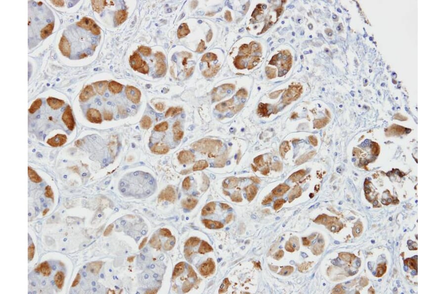 Immunohistochemistry - glutathione S-transferase alpha 2 antibody from Signalway Antibody (22142) - Antibodies.com