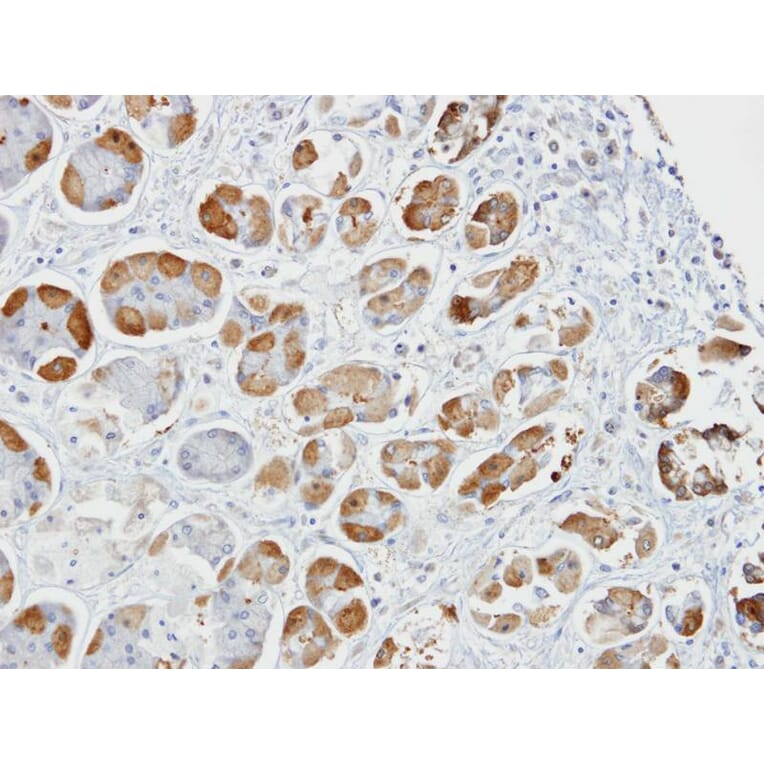 Immunohistochemistry - glutathione S-transferase alpha 2 antibody from Signalway Antibody (22142) - Antibodies.com