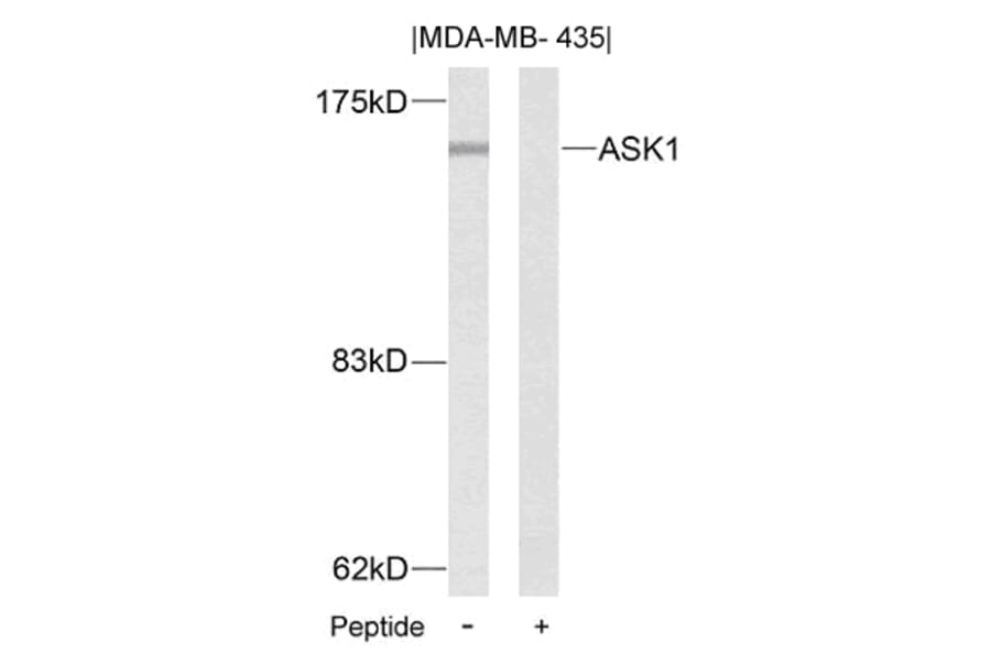 Western blot - ASK1 (Ab-83) Antibody from Signalway Antibody (21125) - Antibodies.com