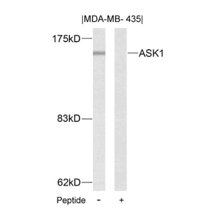 Western blot - ASK1 (Ab-83) Antibody from Signalway Antibody (21125) - Antibodies.com