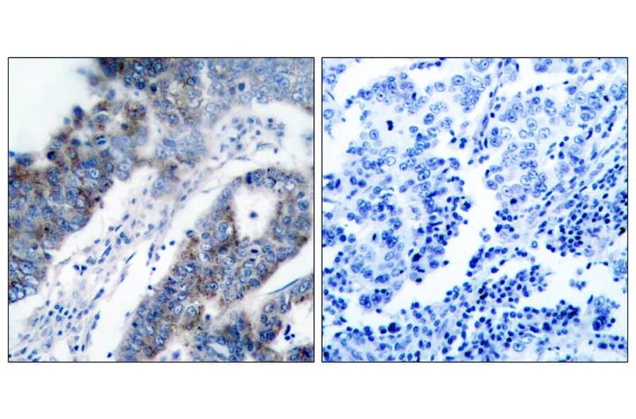 Immunohistochemistry - ASK1 (Ab-83) Antibody from Signalway Antibody (21125) - Antibodies.com