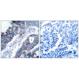 Immunohistochemistry - ASK1 (Ab-83) Antibody from Signalway Antibody (21125) - Antibodies.com