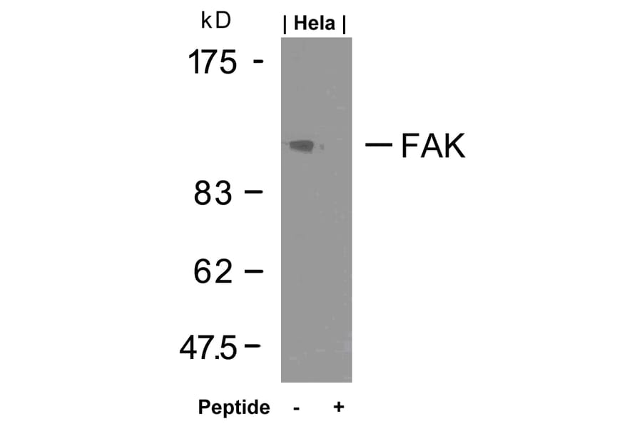 Western blot - FAK (Ab-925) Antibody from Signalway Antibody (21148) - Antibodies.com