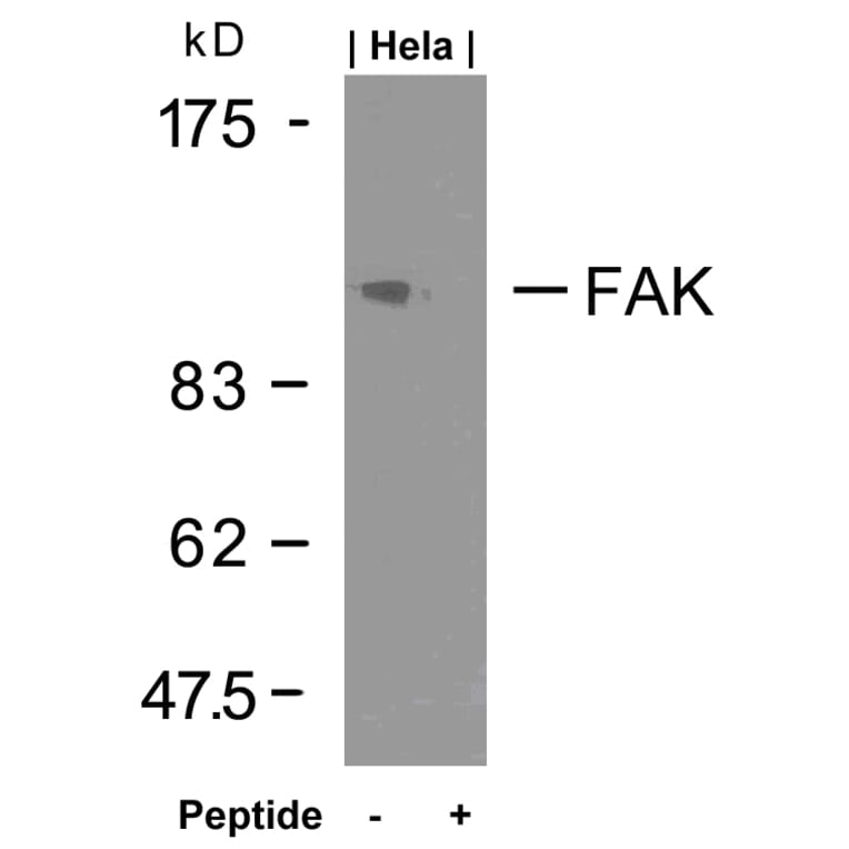Western blot - FAK (Ab-925) Antibody from Signalway Antibody (21148) - Antibodies.com